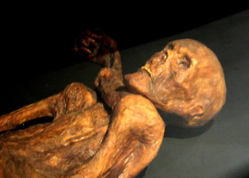 The 5,300-year-old mummified remains of Ötzi the Iceman on display at the South Tyrol Museum of Archaeology in Bolzano, Italy